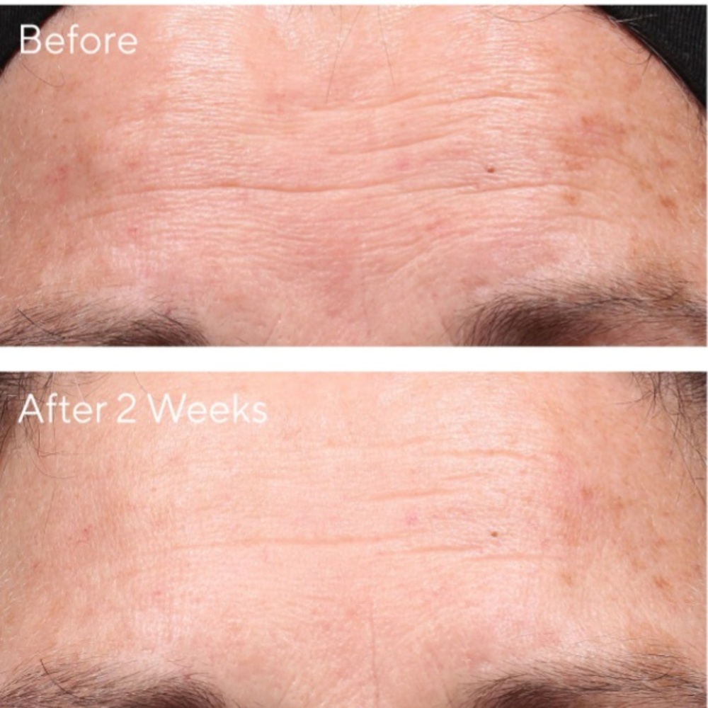 Murad Youth Renewal Retinol Trial Kit - Picture 4 of 4